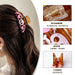dxx-img:798cfe545d6f341cc90644470b6f648f