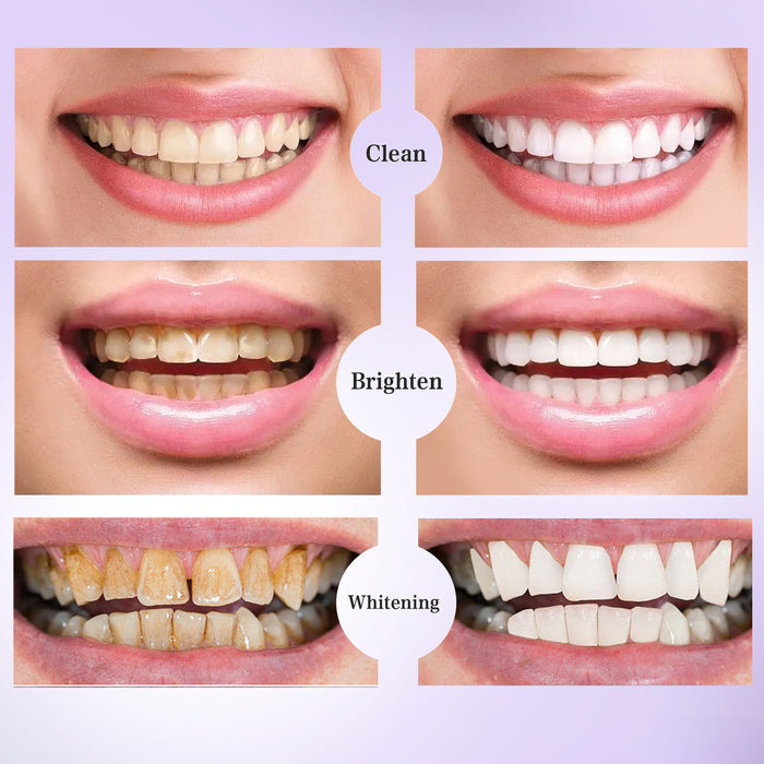 Wholesale V34 Toothpaste for Removing Smoke Stains, Removing Yellow Teeth, Brightening White Teeth, Purple Toothpaste Hair